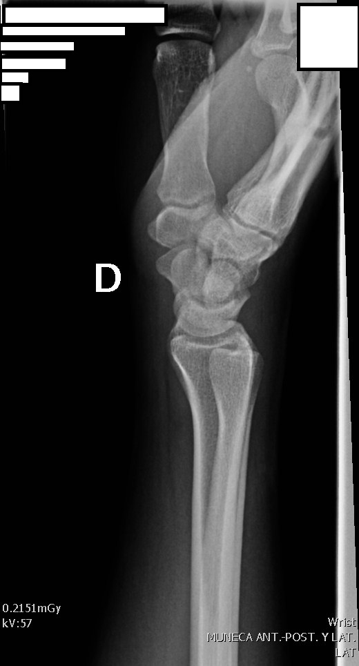 Diagrama Posición Lateral